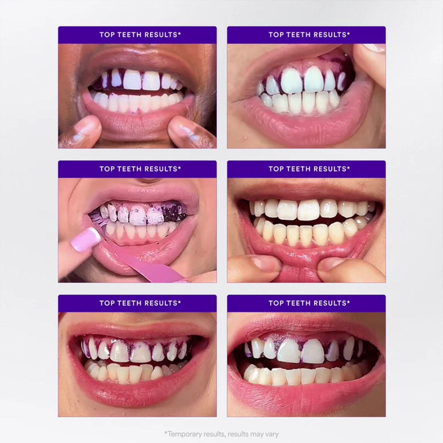 V34 Whitening Strips