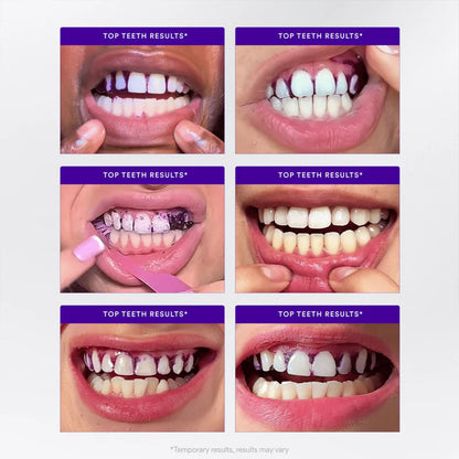 V34 Whitening Strips